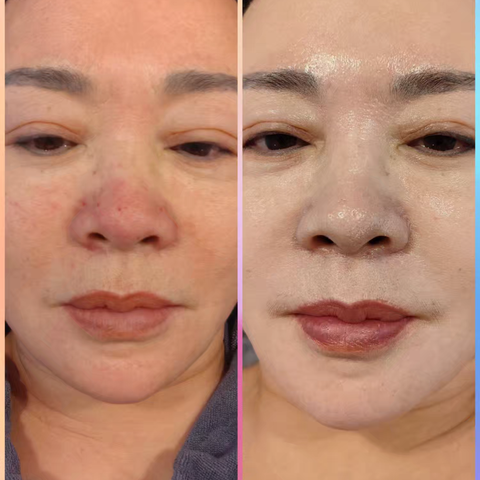 找对了地方，终于焕发美丽光彩