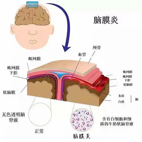 病毒性脑炎