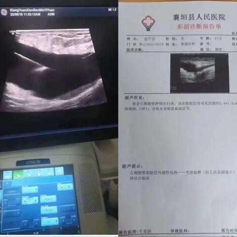 小针眼解决大问题——超声引导下乳腺、甲状腺、浅表肿物穿刺术造福音