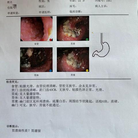 拒绝谈“镜”色变！