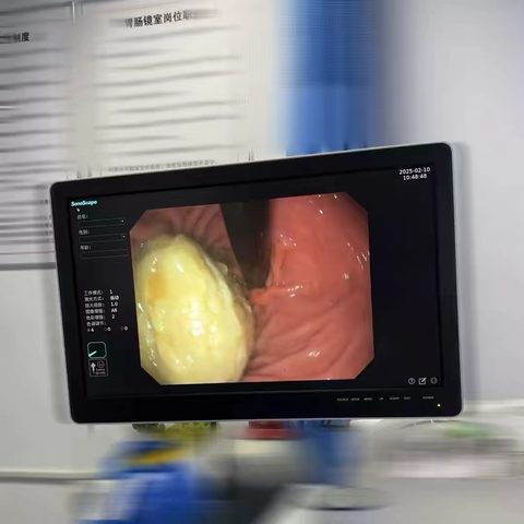 年终体检之胃肠镜篇