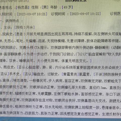 颅内多源供血动静脉瘘行栓塞治疗