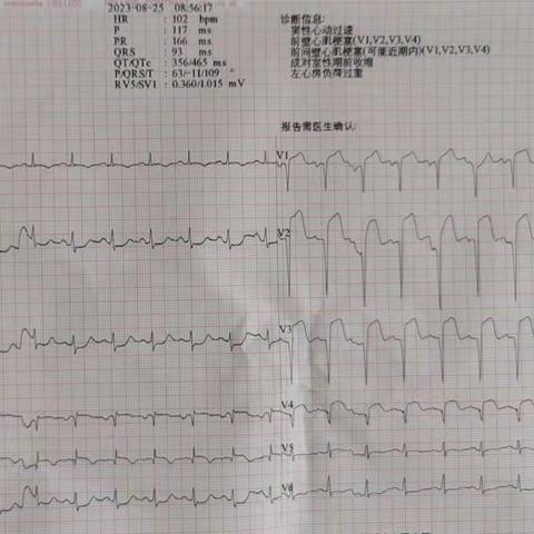 患者：男性，68岁，胸闷、心悸、气短、活动后症状加重2天，恶心、食欲不振1天，来我院就诊。