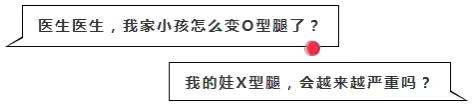 宝宝O型腿、X型腿是怎么了？