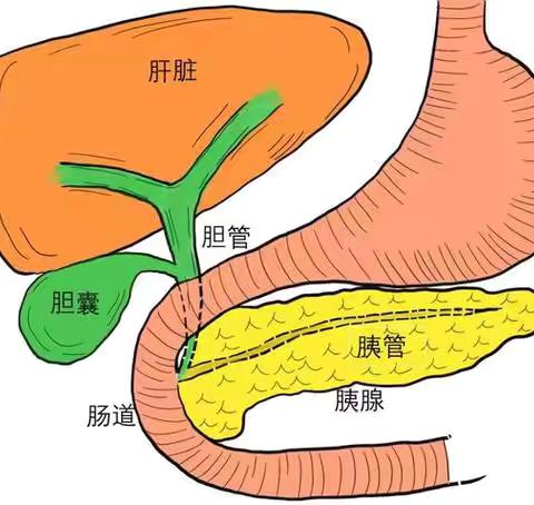 胆囊结石知多少？