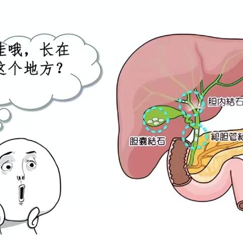 “胆”战心惊，“石”在难受