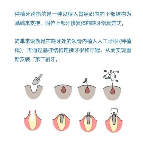 人类的第三副牙齿  拥有真牙般咀嚼力 想吃就吃  身体更健康