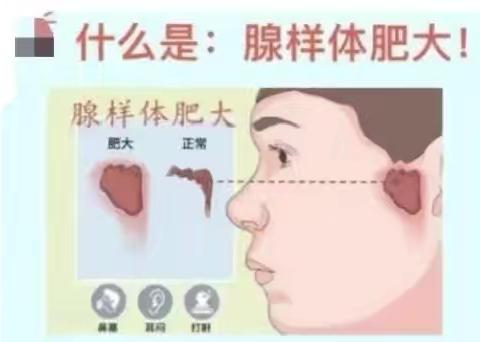 别让“呼噜娃”躲走孩子的成长