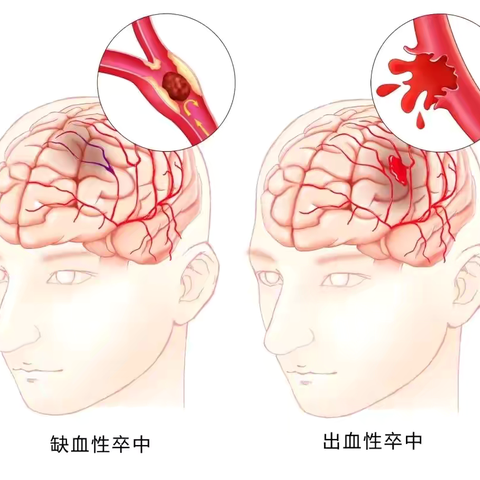 时间就是大脑，时间就是生命