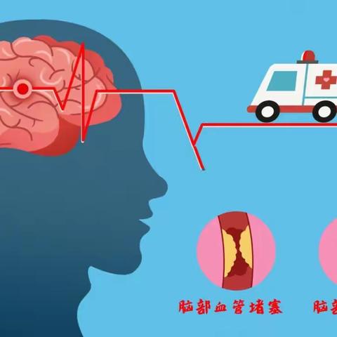 警惕卒中症状         尽早识别救治。