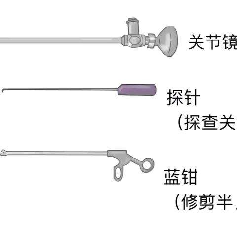 关节“镜”照亮您的生活，让您的关节“镜”善“镜”美！