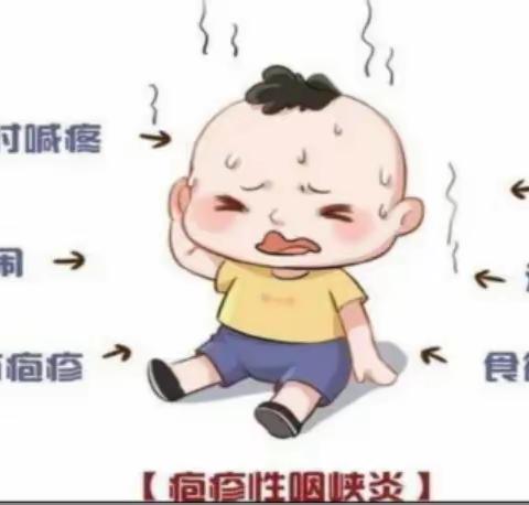 金色摇篮幼儿园提醒您:正确认知疱疹性咽峡炎，高发季来临淡定不慌忙