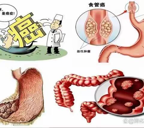 消化道疾病预防——我院开展义诊及健康宣教活动