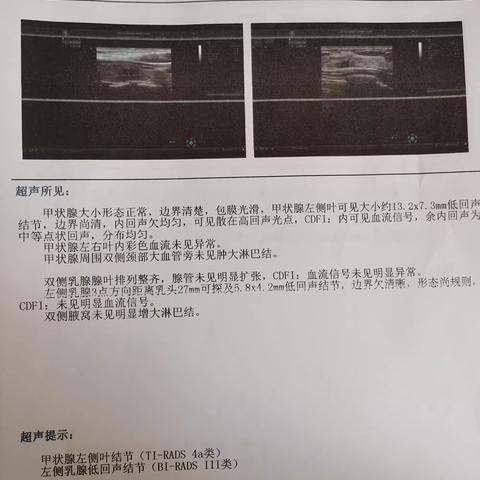 甲状腺结节患者预约