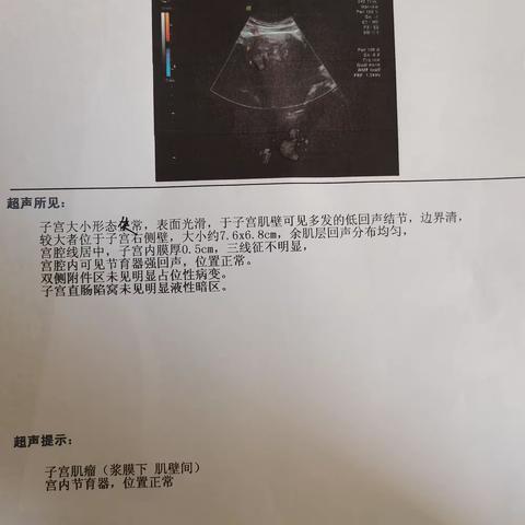 子宫肌瘤及腺肌症预约患者