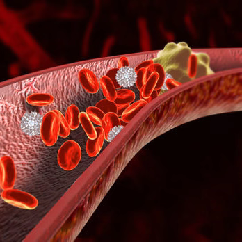 骨科手术后如何预防深静脉血栓的发生呢？