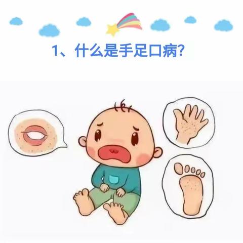 预防“手足口病”，呵护幼儿健康——阳光幼儿园预防手足口病知识宣传