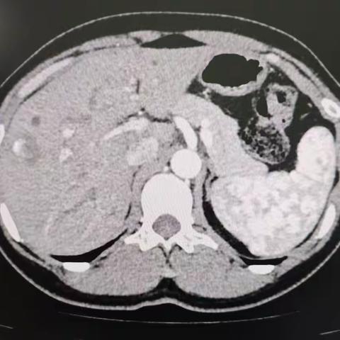 好消息！好消息！淳化县医院开展增强CT、冠脉CT等新业务