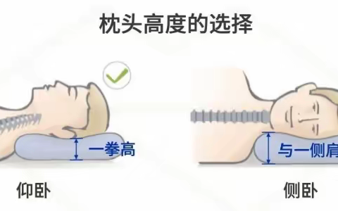 如何保护我们的颈椎