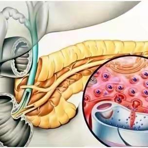 “走进科普”之急性胰腺炎