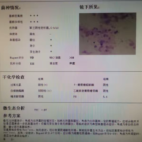 如何解读阴道分泌物（白带常规）微生态分析报告单