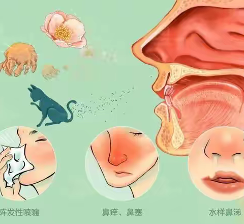 “腺样体肥大”健康防护早知道