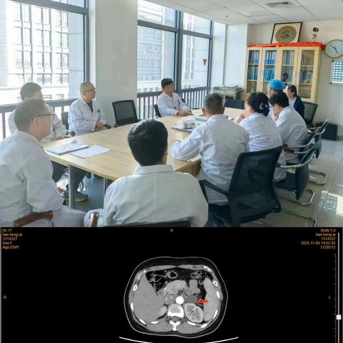 MDT助力泌尿外科规范化诊治肾上腺疾病
