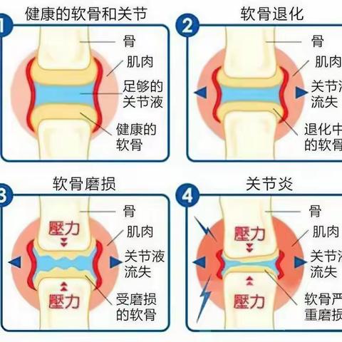 风湿骨痛，7日疏通，3个月重生？