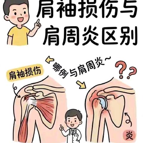 健康宣教：别再混淆！ 肩周炎与肩袖损伤大不同