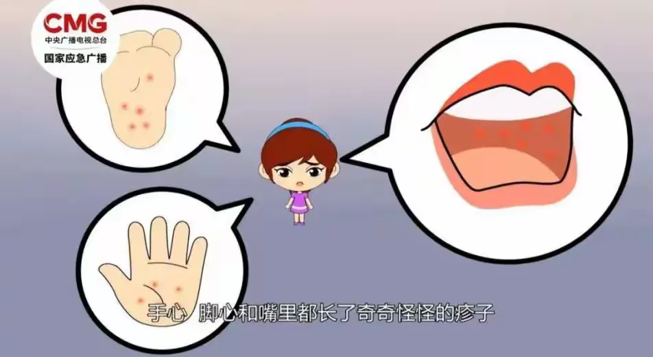 简篇-平坝区乐平镇幼儿园健康防病温馨小提示