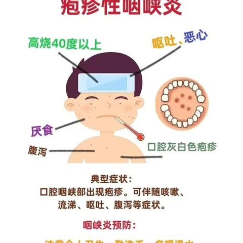 疱疹性咽峡炎———卫生保健知识宣传