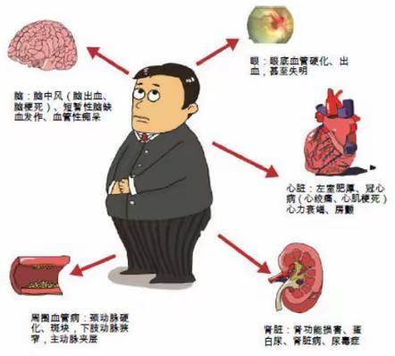 高血压患者健康知识宣教