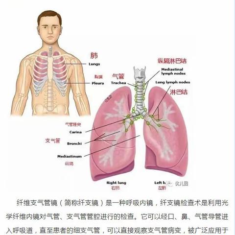 儿童纤维支气管镜