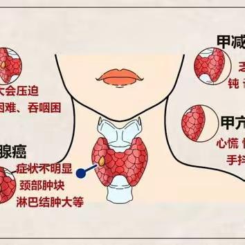 健康科普丨遇到甲状腺结节怎么办？