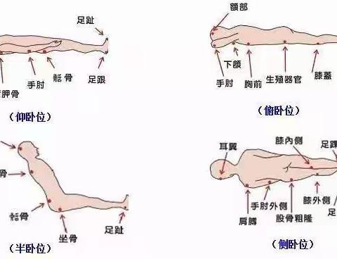 预防压力性损伤知识宣教