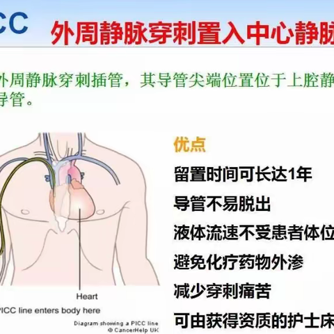 中心静脉管路安全管理--PICC