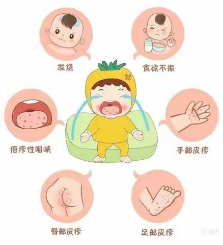 幼儿手足口病预防知识