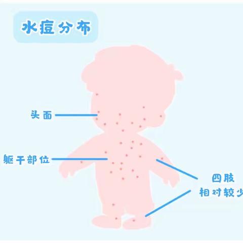 水痘防治 ，预防为主——开封市大纸坊街幼儿园南苑分园冬季传染病预防小知识