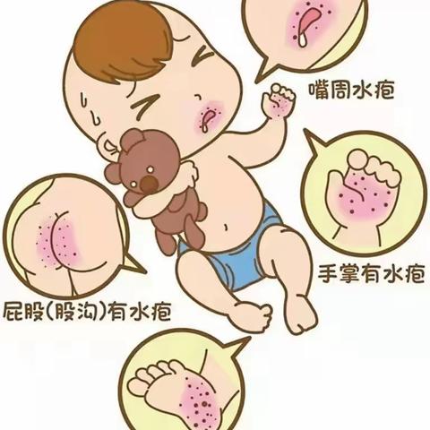 【卫生保健】健康入秋 预防先行 —— 鄠邑区钟楼幼儿园秋季传染病预防知识温馨提示