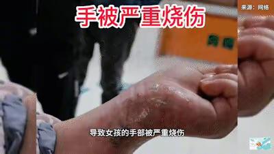 严防炸伤和煤气（一氧化碳）中毒——快乐春节，安全同行！