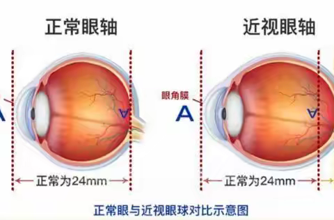 科学防控近视 共筑光明未来