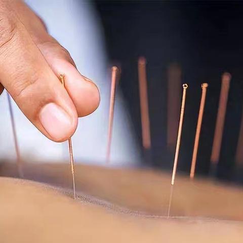 第一次针灸如何准备？从禁忌到注意事项，一次性告诉您