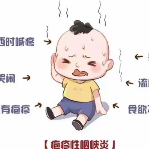 【大龙街沙涌幼儿园卫生保健】健康相伴 —疱疹性咽峡炎预防小知识