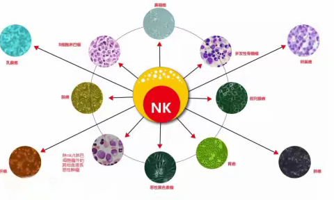 多种癌症的实验性治疗选择—CAR NK细胞疗法及领跑企业