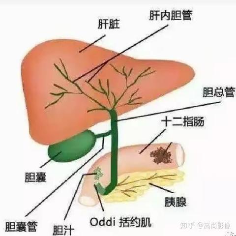 MRI—水成像技术