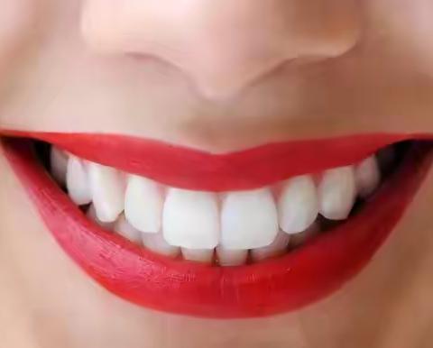 维密丽贝牙齿美学贴面，让笑容从“齿”绽放！
