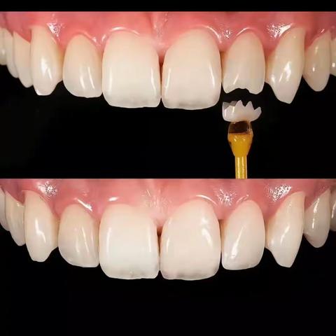 健康源于🦷一颗🦷一份品质，专业的人就是做专业的事