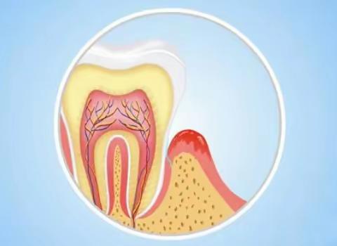 牙齿越来越长？可能是它在作怪！