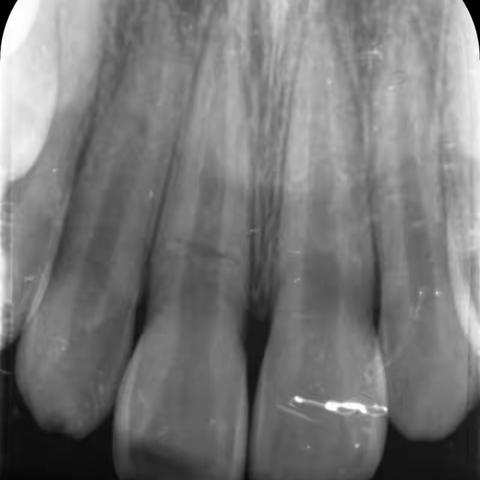 啥叫《维密丽贝点位保存》