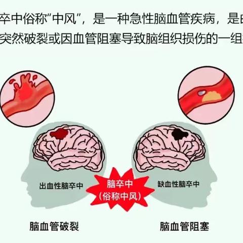 健康科普】脑卒中患者如何进行快速急救处理？    2024年1月16日